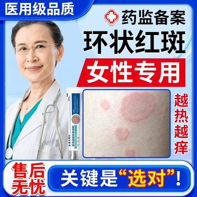 女性离心性环形红斑【温和不刺激