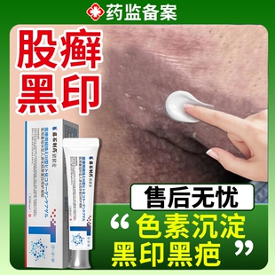 股藓癣去黑去除男士大腿内侧黑印裆部胯下发黑色素沉淀专用软膏DZ