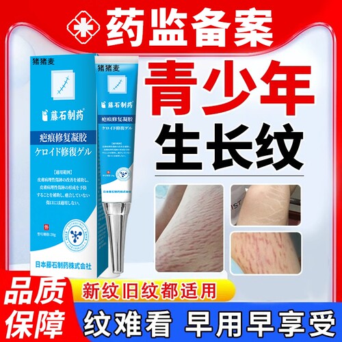 【学生专用】生长纹淡纹肥胖纹