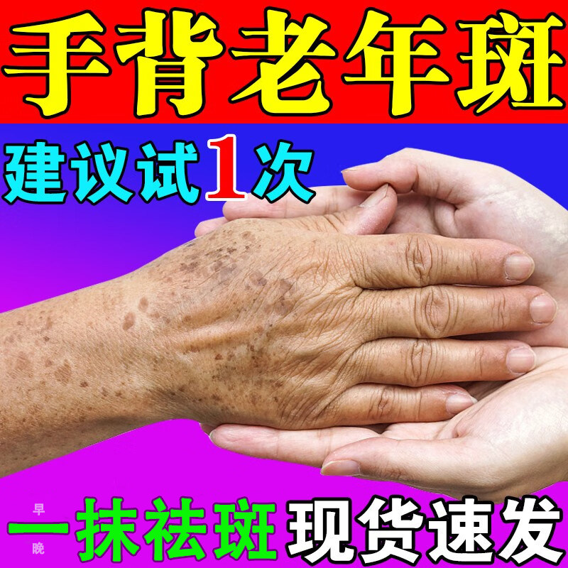 去老年斑的药膏强力去除手部脸部点手背手上专用药水祛黄褐雀斑JW