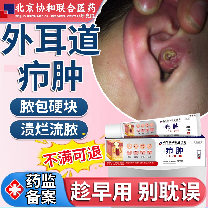 外耳道疖肿专用耳后皮脂腺囊肿耳朵后面长疙瘩粉瘤拔毒搭薬膏贴em