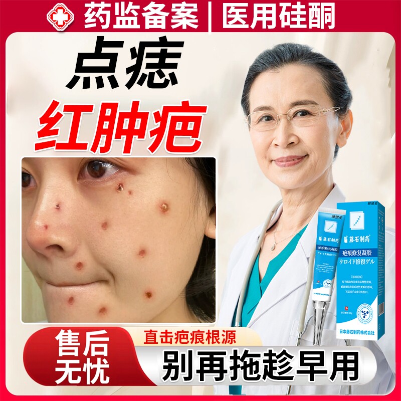 点痣后去疤痕灵红印消印修术后复液除疤膏激光祛痣点斑祛斑专用EM