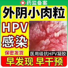 尖锐湿疣女性私处专用膏hpv抗病毒干扰素药膏可搭鬼臼毒素酊膏EM