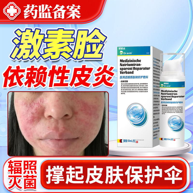 激素脸依赖性皮炎修复护肤品面部过敏皮肤屏障受损红疹痒红血丝JW