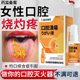 女性灼口综合症舌炎专用舌头灼热疼刺痛麻木口腔喷雾剂药房同售BS