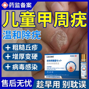 儿童甲周疣甲下疣专用去除手上长硬疙瘩指甲死皮硬皮药房同款膏BS