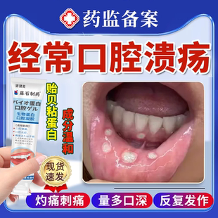 反复口腔溃疡一点口舌生疮灵特黏膜修复效可搭专用牙膏药房同款JW