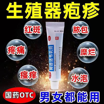 阿昔洛韦软膏25g正品涂带状疱疹后遗症神经痛蛇缠腰疱疹特效药膏