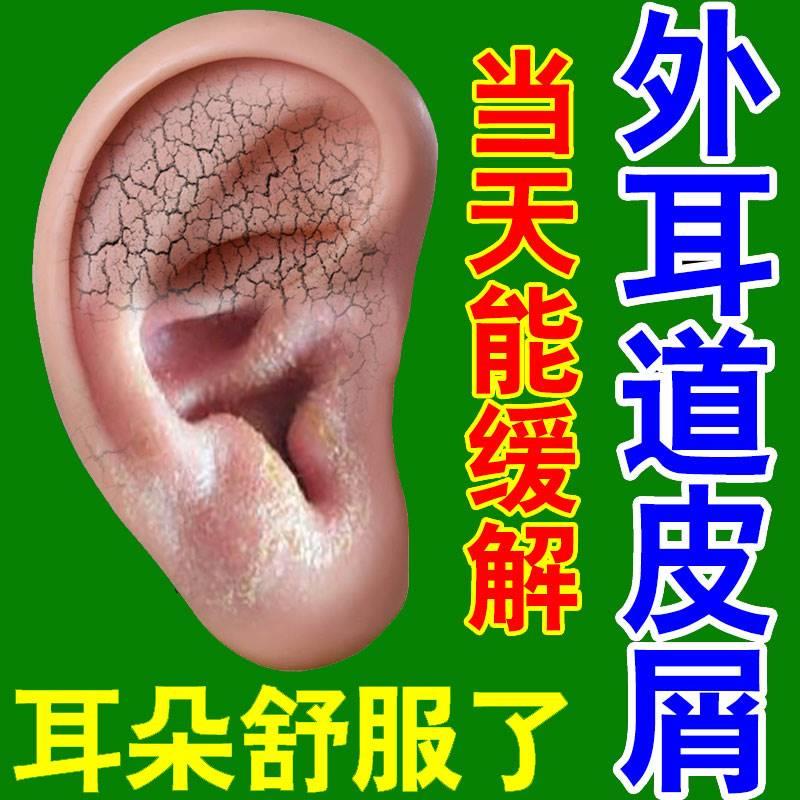 专治外耳道皮屑耳朵痒流脓顽固外耳皮肤瘙痒发炎祛湿用中药乳膏