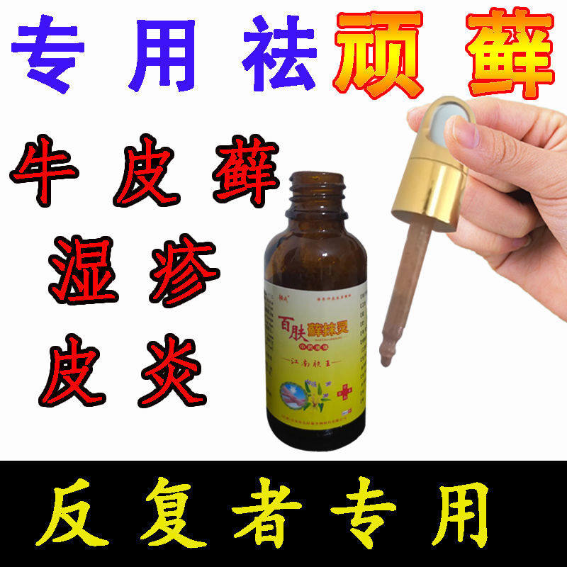 百肤藓抹灵牛皮癣股藓手足藓百草止痒膏银屑病专用花斑鲜止痒药水