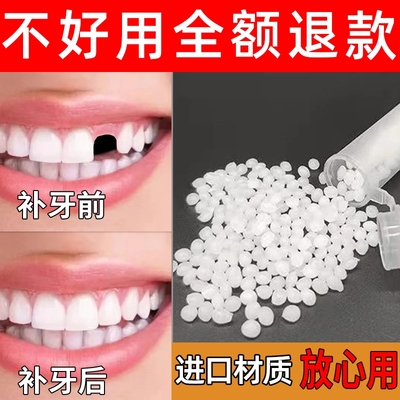 英国进口修补神器自己补永久牙材料假牙套牙仿真牙齿缺牙填充修复