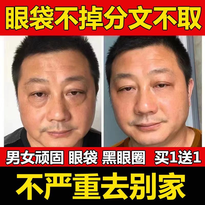 消浮肿神器祛除眼袋克星专治大眼袋提拉紧致眼霜女男士专用 美容护肤/美体/精油 男士眼霜 原图主图