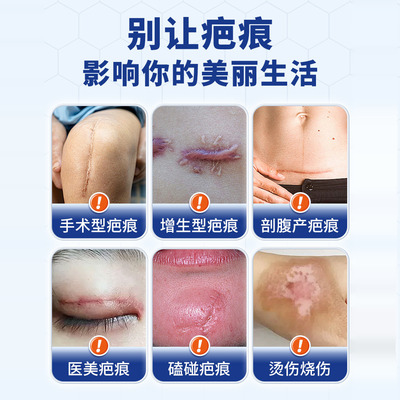南京同仁堂医用祛疤痕贴硅酮凝胶剖腹产手术烫伤增生痘印瘢痕修复