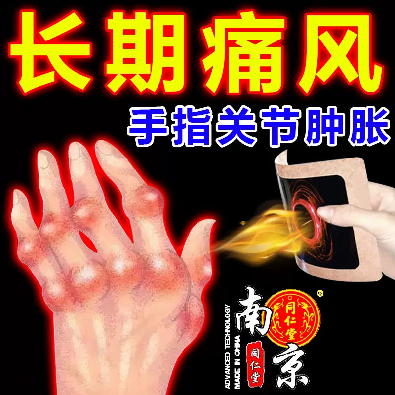 天和追风膏药贴手指头关节痛痛风止痛膏治疗腰腿疼痛祛风散寒活血