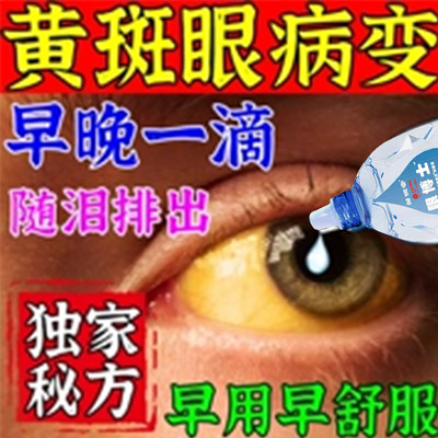 叶黄素滴眼药水眼疲劳老花眼白内障黄斑病变干眼症维持视网膜功能