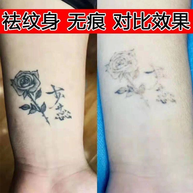 洗纹身神器不留疤无痛无痕纹身药水快速脱色剂祛除纹眉去刺青防疤