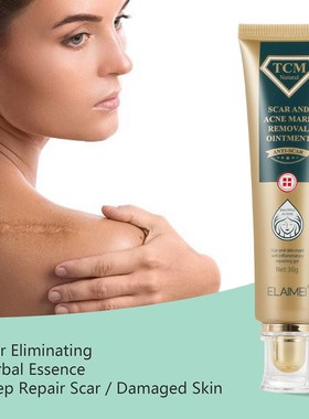 TCM Scar&Acne Mark Removal Gel Ointment Face Pimples Scar St