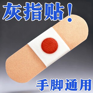 专用贴植物萃取脚趾手指甲专用 指甲贴正品 已愈100万人