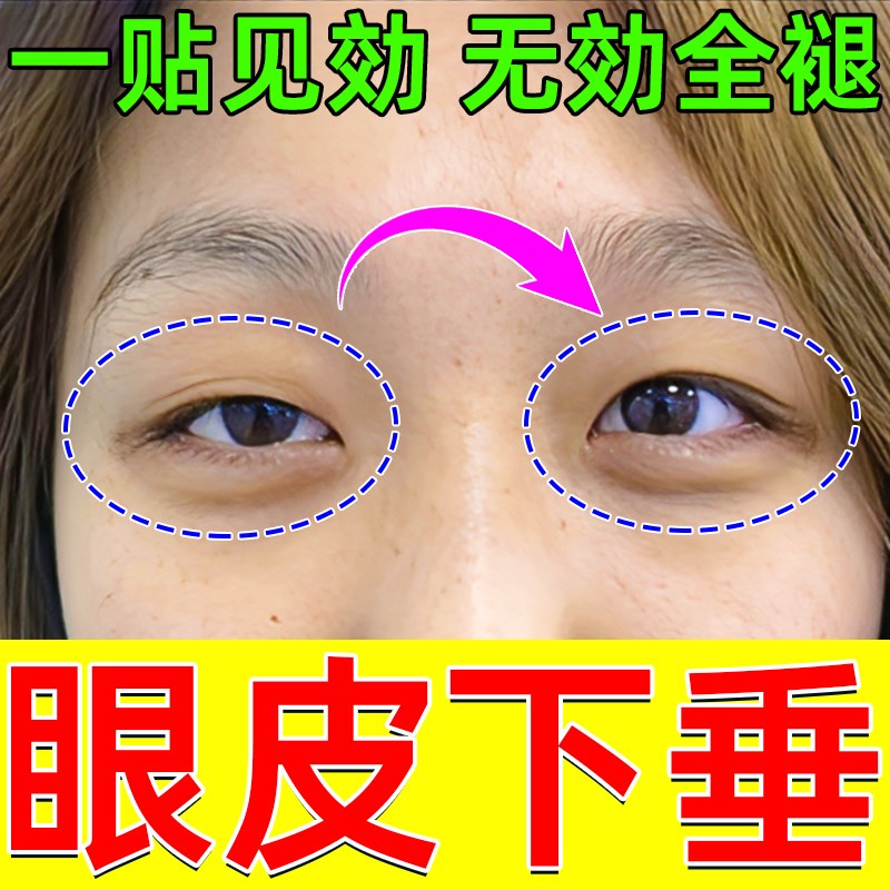 眼皮下垂提拉眼贴防松弛撑上双眼皮贴非消肿眼泡中老年非专用神器