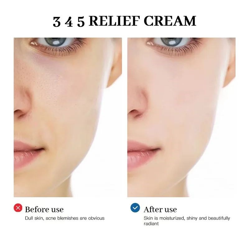 Moisturizer 345 Relief Cream Without Weight  Ultra-lightweig
