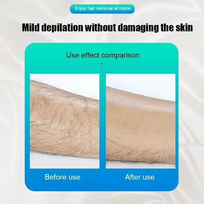 Crystal Hair Remover New Painless Physical Hair Removal Epi