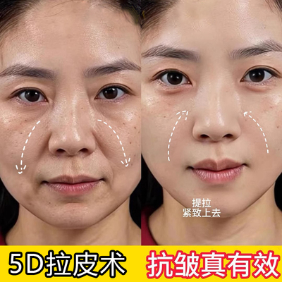 【美容院爆賣】淡化法令纹嘴角纹提拉紧致提升凝水微晶贴