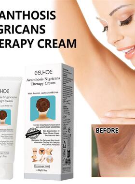 Underarm Whitening Creams For Dark Skin Lightening Body Crot