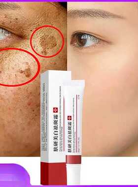 Whitening Freckle Cream Remove Melasma Cream Remove Dark Spo