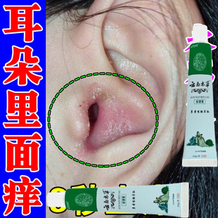 耳朵里面痒红肿外耳道起皮专用膏