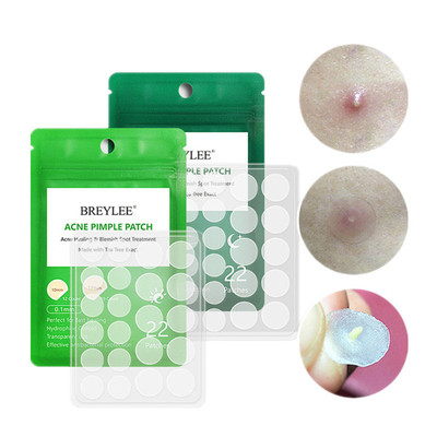 Acne Pimple Patch Stickers Acne Treatment Pimple Remover To