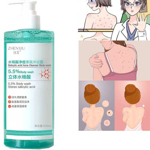Salicylic Acid Body Wash Mild Exfoliating Daily Acne沐浴露