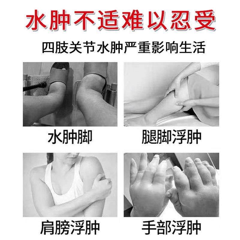 邹润安消水肿喷剂肿胀缓解肩膀手臂小腿关节久站水肿手脚浮肿