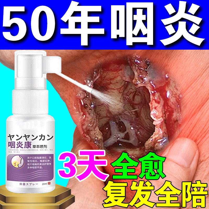 日本咽炎特效药喷雾慢性咽炎除根咽喉炎治根止咳化痰雾化专用喷剂