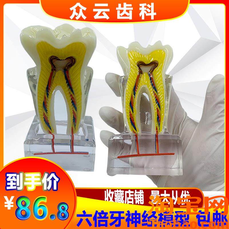 口腔牙科教学教具6倍牙神经模型c水晶牙齿结构造解剖医患沟通包邮