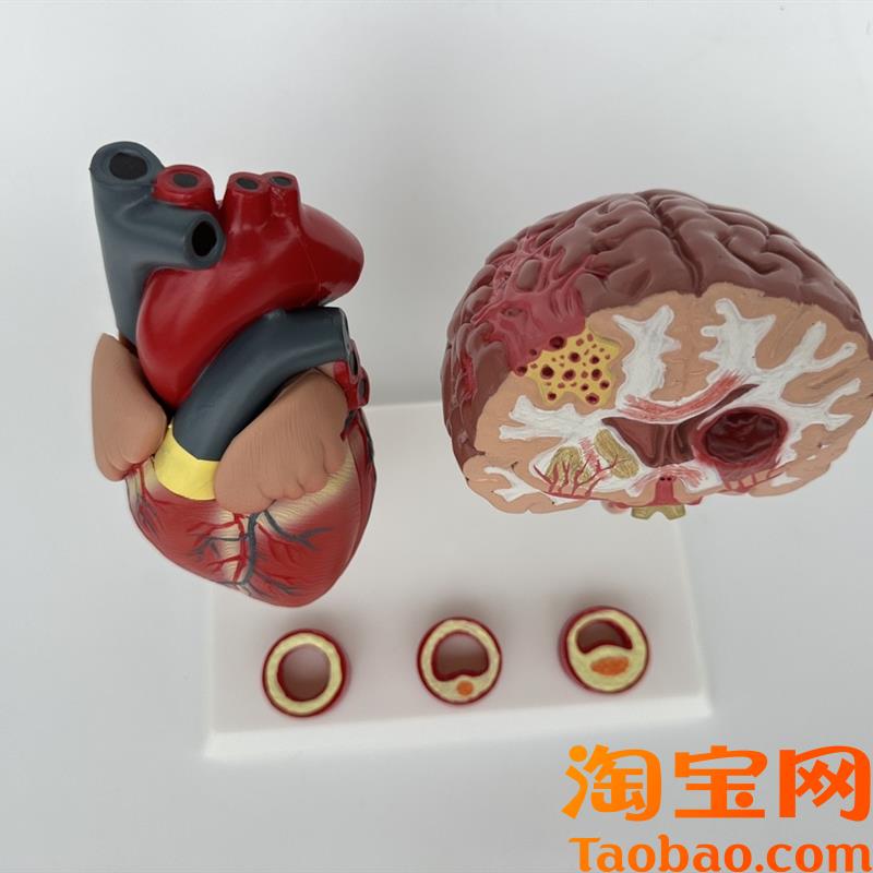 原装适用人体心脑血管展示模型血压高心脏模具与心血管模型对比教