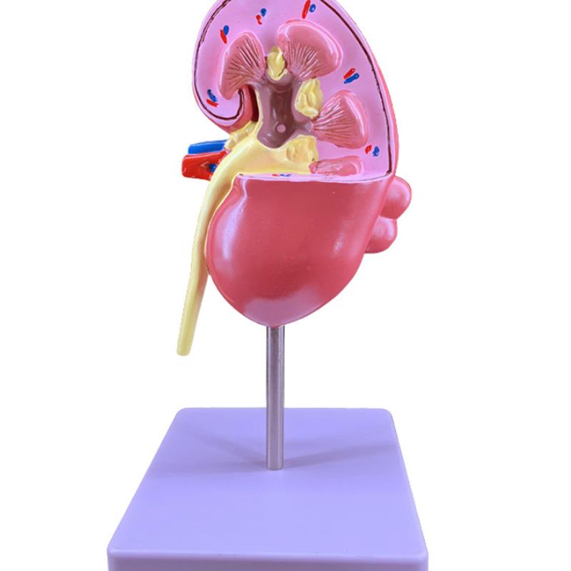 原装适用人体肾解剖模型正常肾部模型,病理肾脏模型专业内脏器官