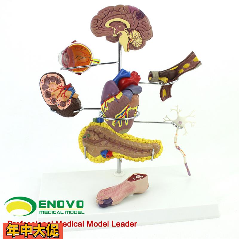 ENOVO颐诺人体医学糖尿病模型糖尿病并发症大脑心脏胰腺神经元足