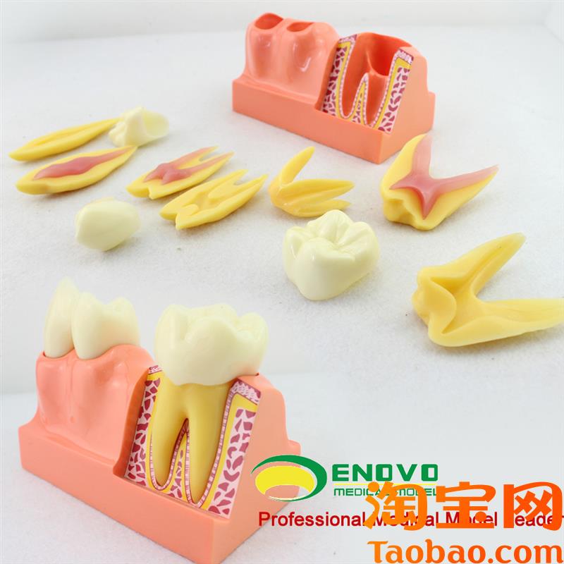 原装适用ENOVO颐诺牙体分解模型牙齿解剖模型口腔科教学牙体解剖