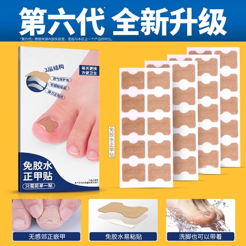 甲沟矫正器炎神器正甲贴指甲贴片嵌甲脚趾甲往肉里长纠正填充垫片