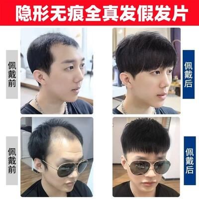 男生假发微分碎盖免打理帅气无痕隐形头顶全真发男款男式黑色发片