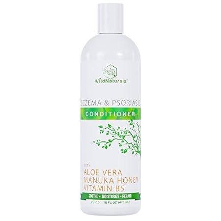 Eczema Psoriasis Conditioner and Dry Scalp Treatment - An