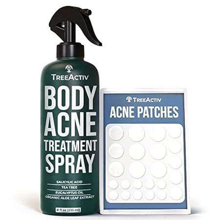 TreeActiv Body Acne Treatment Spray， 8 oz， 2% Salicylic A