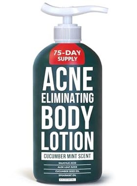 TreeActiv Acne Eliminating Body Lotion， 8 oz， Salicylic A