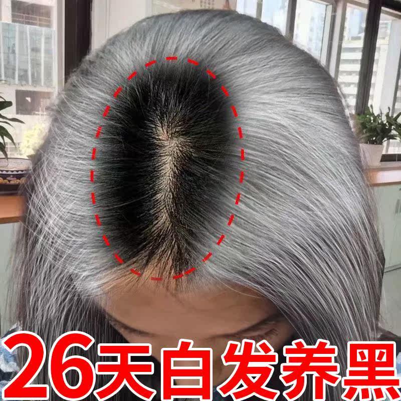 【薇娅推荐】 白发三千丈,缘愁似个长,不用再拔,白发没了.