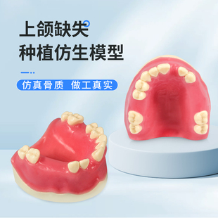 口腔种植练习模型上下颌缺失种植教学实操上颌窦提升牙科种植模型