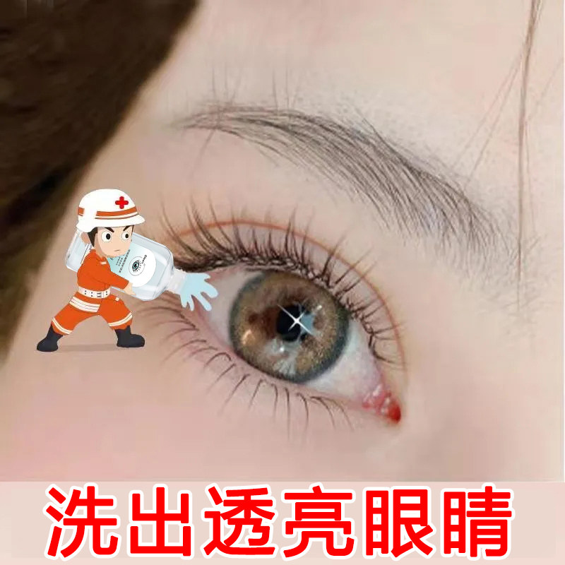 【眼部清洗护理】露梦诗洗眼液 深层清洁 眼睛干涩护理液 买3发5~