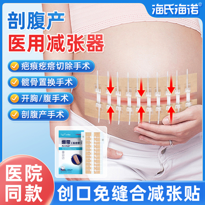 海氏海诺减张器医用剖腹产伤口免缝合愈合疤痕甲状腺减张贴