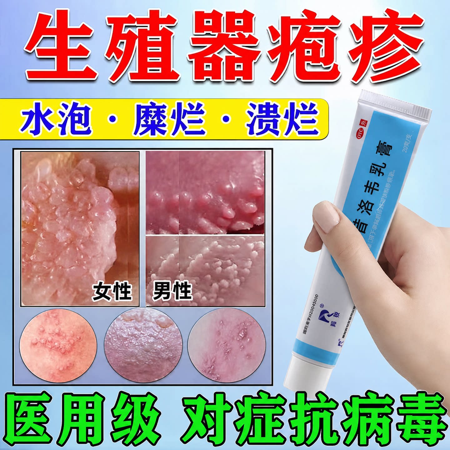 阿昔洛韦抗病毒乳膏正品官方旗舰店凝胶生殖器带状疱疹药膏非效特