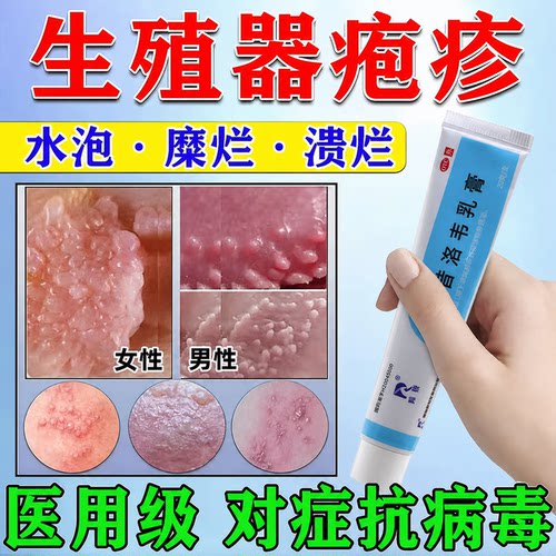 [羚锐]阿昔洛韦乳膏3%*20g*1支/盒