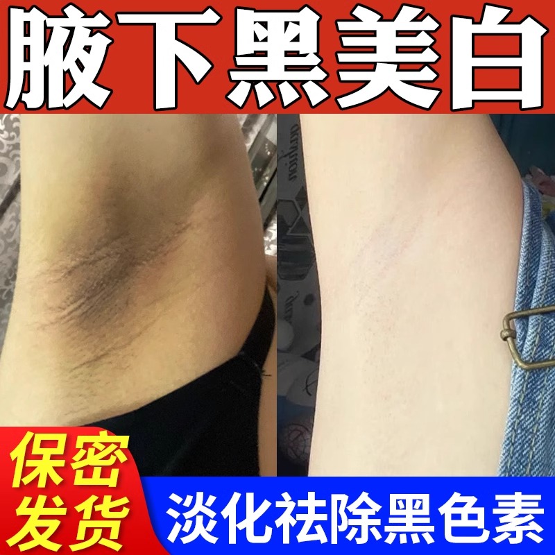 腋下黑色素沉淀脖子去除腋窝除美黑白大腿内侧胳肢窝屁股坐印关节